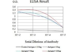 Black line: Control Antigen (100 ng),Purple line: Antigen (10 ng), Blue line: Antigen (50 ng), Red line:Antigen (100 ng)