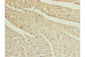 Immunohistochemistry of paraffin-embedded human heart tissue using ABIN7151077 at dilution of 1:100 (MYLIP anticorps  (AA 266-445))
