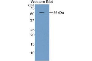 Western Blotting (WB) image for anti-Mannose-Binding Lectin (Protein C) 2, Soluble (MBL2) (AA 19-244) antibody (ABIN1859767) (MBL2 anticorps  (AA 19-244))