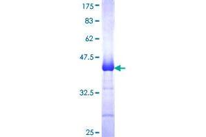 Image no. 1 for Phosphoinositide 3 Kinase, p85 alpha (PI3K p85a) (AA 251-360) protein (GST tag) (ABIN1315082)