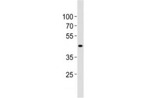 Western blot analysis of lysate from human kidney tissue lysate using SOX7 antibody diluted at 1:1000.