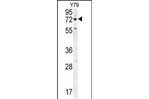 Western blot analysis in Y79 cell line lysates (35ug/lane). (RFT1 anticorps  (C-Term))