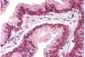 anti-LIM Homeobox 2 (LHX2) (AA 239-254) antibody