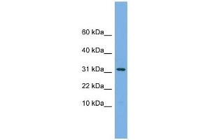 MRPS6 antibody used at 1 ug/ml to detect target protein. (MRPS6 anticorps  (Middle Region))