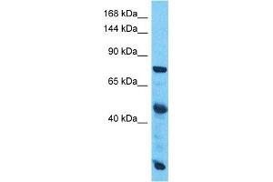 Host:  Rabbit  Target Name:  SLC38A10  Sample Type:  Esophagus Tumor lysates  Antibody Dilution:  1. (SLC38A10 anticorps  (C-Term))