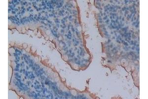 Detection of ENPEP in Rat Small intestine Tissue using Polyclonal Antibody to Aminopeptidase A (ENPEP)