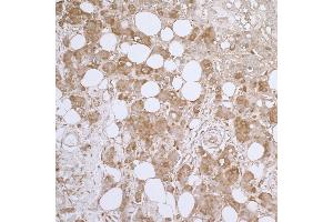 Immunohistochemistry (IHC) image for anti-Heat Shock 27kDa Protein 1 (HSPB1) (AA 155-205) antibody (ABIN7453920) (HSP27 anticorps  (AA 155-205))