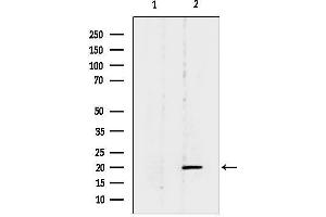 anti-Betacellulin (BTC) (N-Term) antibody
