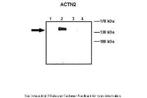 Lanes:   Lane1: 10 ug ACTN1-GFP transfected COS-7 lysate Lane2: 10 ug ACTN2-GFP transfected COS-7 lysate Lane3: 10 ug ACTN3-GFP transfected COS-7 lysate Lane4: 10 ug ACTN4-GFP transfected COS-7 lysate  Primary Antibody Dilution:   1: 1000  Secondary Antibody:   Anti-rabbit HRP  Secondary Antibody Dilution:   1:5000  Gene Name:   ACTN2  Submitted by:   Johannes W.