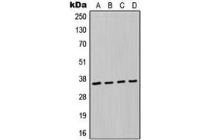 Western blot analysis of MAGEA6 expression in A549 (A), MCF7 (B), NIH3T3 (C), H9C2 (D) whole cell lysates. (MAGEA6 anticorps  (Center))