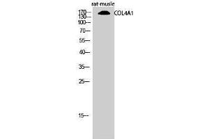 Western Blotting (WB) image for anti-Collagen, Type IV, alpha 1 (COL4A1) (N-Term) antibody (ABIN3174484) (COL4A1 anticorps  (N-Term))