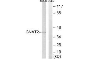 Western blot analysis of extracts from COLO cells, using GNAT2 antibody.