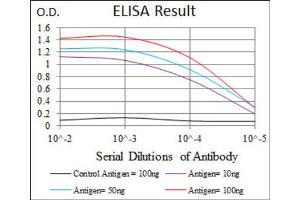 Red: Control Antigen (100ng) ; Purple: Antigen (10ng) ; Green: Antigen (50ng) ; Blue: Antigen (100ng). (Moesin anticorps)
