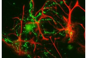 Indirect immunofluorescence labeling of cultured rat astrocytes and hippocampus neurons with anti-GFAP (red; dilution 1 : 1000) and anti-synaptophysin (green; cat.