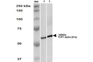 Western Blot analysis of Human A431 and HEK293 cell lysates showing detection of TCP1 alpha protein using Rat Anti-TCP1 alpha Monoclonal Antibody, Clone 91a . (TCP1 alpha/CCTA anticorps  (C-Term) (HRP))