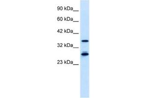 Western Blotting (WB) image for anti-Metal Response Element Binding Transcription Factor 2 (MTF2) antibody (ABIN2460909) (MTF2 anticorps)