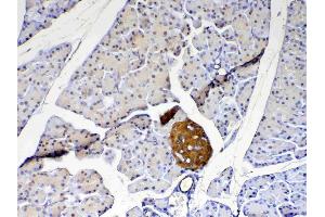IHC analysis of PARK7 / DJ1 using anti-PARK7 / DJ1 antibody .