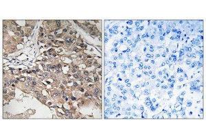 Immunohistochemistry (IHC) image for anti-Mitogen-Activated Protein Kinase Kinase Kinase 7 (MAP3K7) (Thr187) antibody (ABIN1848228)