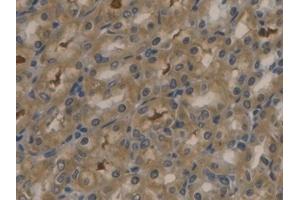 Detection of APOB in Rat Stomach Tissue using Polyclonal Antibody to Apolipoprotein B (APOB)