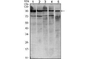 Western blot analysis using STAT6 mouse mAb against HEK293 (1), NIH/3T3 (2), MCF-7 (3), Raw246. (STAT6 anticorps)