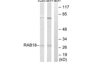 Western blot analysis of extracts from HuvEc cells and MCF-7 cells, using RAB18 antibody. (RAB18 anticorps  (Internal Region))