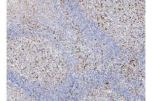 IHC analysis of RAB27A using anti-RAB27A antibody (ABIN7602714). (RAB27A anticorps  (AA 98-216))