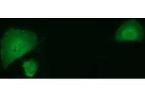 Anti-SMAD2 mouse monoclonal antibody (ABIN2453654) immunofluorescent staining of COS7 cells transiently transfected by pCMV6-ENTRY SMAD2 (RC204604). (SMAD2 anticorps)