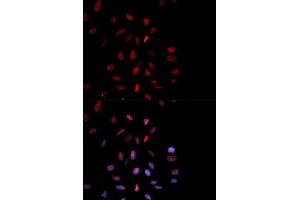 Immunofluorescence analysis of MCF-7 cells using Phospho-FOS-T232 antibody (ABIN5969895). (c-FOS anticorps  (pThr232))