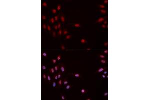 Immunofluorescence analysis of MCF-7 cells using Phospho-CHEK1-S317 antibody (ABIN5969879). (CHEK1 anticorps  (pSer317))