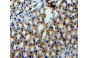 Used in DAB staining on fromalin fixed paraffin-embedded kidney tissue
