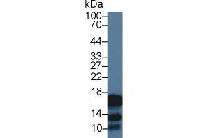 Western Blot; Sample: Human Saliva; Primary Ab: 3µg/ml Rabbit Anti-Human CST2 Antibody Second Ab: 0. (CST2 anticorps  (AA 21-141))