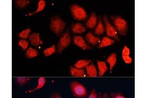 Immunofluorescence analysis of HeLa cells using CDK7 Polyclonal Antibody at dilution of 1:100 (40x lens).