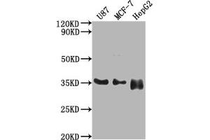 Western Blot Positive WB detected in: U87 whole cell lysate, MCF-7 whole cell lysate, HepG2 whole cell lysate All lanes: HMGCL antibody at 1:2000 Secondary Goat polyclonal to rabbit IgG at 1/50000 dilution Predicted band size: 35, 27, 21 kDa Observed band size: 35 kDa (HMGCL anticorps  (AA 28-325))