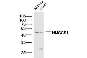 Lane 1: Mouse kidney lysates, Lane 2: Mouse liver lysates probed with HMGCS1 Polyclonal Antibody, Unconjugated  at 1:300 overnight at 4˚C. (HMGCS1 anticorps  (AA 41-150))