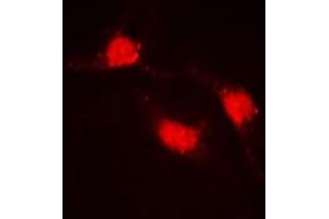 Immunofluorescent analysis of Beta-catenin staining in HeLa cells. (beta Catenin anticorps  (C-Term))