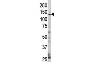 Western blot analysis of ErbB4 / HER4 antibody and HL-60 cell lysate.