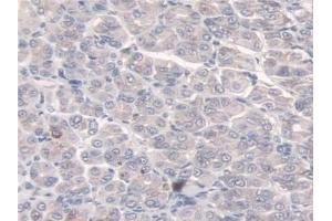 Detection of SULF2 in Mouse Esophagus Tissue using Polyclonal Antibody to Sulfatase 2 (SULF2) (SULF2 anticorps  (AA 337-654))