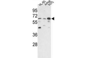 Western blot of hPPP3CC-E33 AP31353PU-N in HL-60, Jurkat, A375 cell line lysates (35 ug/lane). (PPP3CC anticorps  (N-Term))