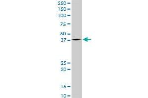 LHX4 monoclonal antibody (M05), clone 4D7. (LHX4 anticorps  (AA 208-306))