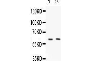 Anti-PKLR Picoband antibody, Western blotting All lanes: Anti PKLR  at 0. (PKLR anticorps  (C-Term))