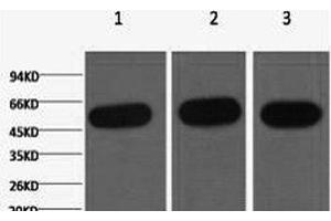 Western Blot analysis of 1) Hela, 2) Mouse kidney, 3) Rat heart using beta Tubulin Monoclonal Antibody at dilution of 1:5000. (TUBB anticorps)
