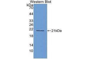 Western blot analysis of recombinant Human IFNa4.