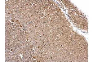 IHC-P Image O-GlcNAc transferase antibody detects O-GlcNAc transferase protein at cytoplasm and nucleus on rat hind brain by immunohistochemical analysis.