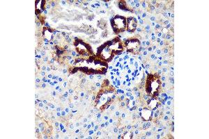 Immunohistochemistry of paraffin-embedded Mouse kidney using EML4 Rabbit pAb (ABIN7266891) at dilution of 1:100 (40x lens). (EML4 anticorps  (AA 360-560))