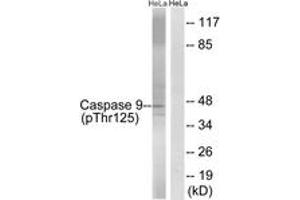 Western blot analysis of extracts from HeLa cells treated with TNF 20ng/ml 5'+calyculinA 50ng/ml 5', using Caspase 9 (Phospho-Thr125) Antibody. (Caspase 9 anticorps  (pThr125))