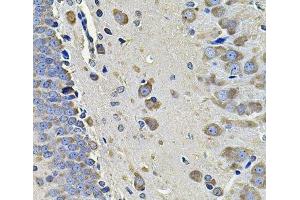 Immunohistochemistry of paraffin-embedded Rat brain using EIF3C Polyclonal Antibody at dilution of 1:100 (40x lens). (EIF3C anticorps)