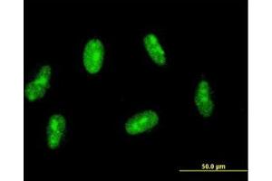 Image no. 2 for anti-Sin3A-Associated Protein, 30kDa (SAP30) (AA 131-220) antibody (ABIN599070) (SAP30 anticorps  (AA 131-220))