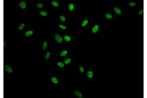 Immunofluorescence staining of Hela Cells with ABIN7127805 at 1:50, counter-stained with DAPI.