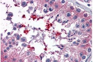 Human Testis: Formalin-Fixed, Paraffin-Embedded (FFPE) (ABCD4 anticorps  (AA 136-149))