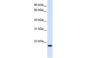 NKAIN1 antibody used at 1 ug/ml to detect target protein.
